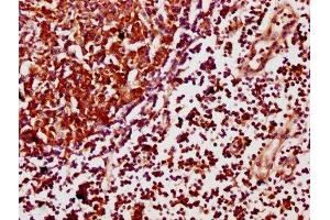 IHC image of ABIN7169831 diluted at 1:500 and staining in paraffin-embedded human lymph node tissue performed on a Leica BondTM system. (SCIMP anticorps  (AA 59-145))