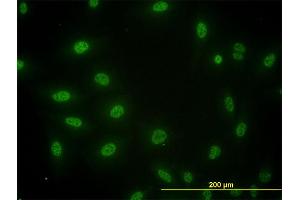 anti-SMAD, Mothers Against DPP Homolog 3 (SMAD3) (AA 1-110) antibody