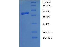 SDS-PAGE (SDS) image for Morf4 Family Associated Protein 1-Like 1 (MRFAP1L1) (AA 1-127), (full length) protein (GST tag) (ABIN5709959)