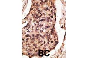 Immunohistochemistry (IHC) image for anti-Sialic Acid Binding Ig-Like Lectin 8 (SIGLEC8) antibody (ABIN2998632)
