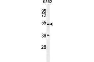 UAP1L1 Antibody (N-term) western blot analysis in K562 cell line lysates (35 µg/lane). (UAP1L1 anticorps  (N-Term))