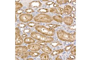 Immunohistochemistry of paraffin-embedded rat kidney using PCBD1 Rabbit mAb (ABIN7269743) at dilution of 1:150 (40x lens).