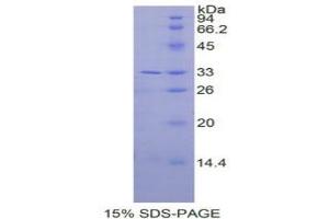 SDS-PAGE analysis of Human IL31RA Protein. (IL31RA Protéine)