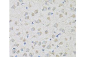 Immunohistochemistry of paraffin-embedded Mouse brain using PENK Polyclonal Antibody at dilution of 1:100 (40x lens).