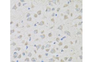 Immunohistochemistry of paraffin-embedded Mouse brain using PENK Polyclonal Antibody at dilution of 1:100 (40x lens). (Enkephalin anticorps)