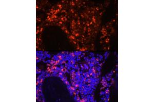 Immunofluorescence analysis of mouse bone marrow cells using Neutrophil Elastase (ELANE) Rabbit pAb (ABIN6131604, ABIN6140110, ABIN6140111 and ABIN6216843) at dilution of 1:250 (40x lens).