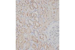 Immunohistochemical analysis of B on paraffin-embedded Human kidney tissue was performed on the Leica®BOND RXm. (SPHK2 anticorps  (C-Term))