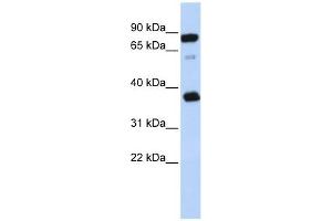 BCAP29 antibody used at 1 ug/ml to detect target protein. (BCAP29 anticorps  (Middle Region))