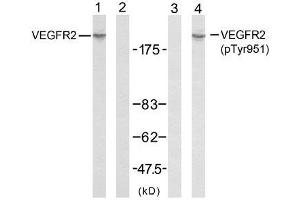 Western blot analysis of extracts from SK-OV3 cells using VEGFR2 (Ab-951) antibody (E021079, Line 1 and 2) and VEGFR2 (phospho-Tyr951) antibody (E011086, Line 3 and 4). (VEGFR2/CD309 anticorps  (pTyr951))