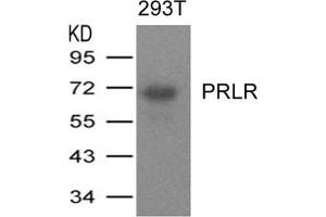 Western blot analysis of extracts from 293T cells expressing human PRLR protein using PRLR Antibody. (Prolactin Receptor anticorps)