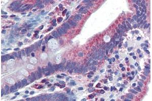 Human Small Intestine (formalin-fixed, paraffin-embedded) stained with NR1I2 antibody ABIN462202 followed by biotinylated goat anti-rabbit IgG secondary antibody ABIN481713, alkaline phosphatase-streptavidin and chromogen.