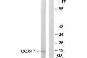 Western blot analysis of extracts from A549 cells, using COX41 antibody. (COX IV anticorps  (N-Term))
