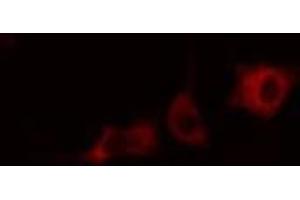 ABIN6266972 staining HepG2  cells by IF/ICC.