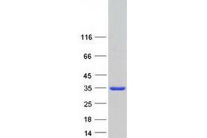Validation with Western Blot