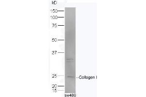 SW480 lysates probed with Rabbit Anti-Pro-Collagen I Polyclonal Antibody, Unconjugated  at 1:5000 for 90 min at 37˚C. (Collagen Type I anticorps  (AA 1321-1400))