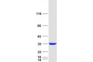 Validation with Western Blot