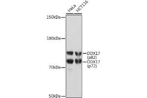DDX17 anticorps