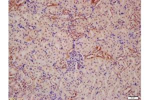 Formalin-fixed and paraffin embedded mouse kidney labeled with Anti-ATG13 Polyclonal Antibody, Unconjugated  at 1:200 followed by conjugation to the secondary antibody and DAB staining (ATG13 anticorps  (AA 51-150))