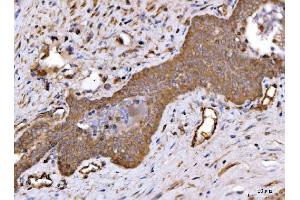 IHC analysis of ch TOG/CKAP5 using anti-ch TOG/CKAP5 antibody (ABIN6719294). (CKAP5 anticorps  (AA 1-221))