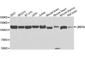 Western blot analysis of extract of various cells, using UBE3A antibody. (ube3a anticorps)