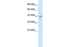 WB Suggested Anti-ZNF237 Antibody Titration:  1.