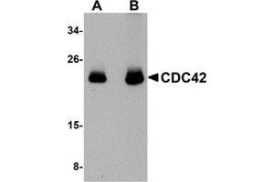 Western Blotting (WB) image for anti-Cell Division Cycle 42 (GTP Binding Protein, 25kDa) (CDC42) (N-Term) antibody (ABIN1031310) (CDC42 anticorps  (N-Term))
