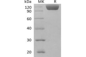 Western Blotting (WB) image for Sialic Acid Binding Ig-Like Lectin 10 (SIGLEC10) (Active) protein (Fc Tag) (ABIN7319822) (SIGLEC10 Protein (Fc Tag))