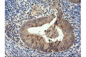Image no. 6 for anti-HRas proto-oncogene, GTPase (HRAS) antibody (ABIN1498714) (HRAS anticorps)