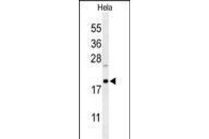 Western blot analysis of CLEC2B Antibody in Hela cell line lysates (35ug/lane) (CLEC2B anticorps  (AA 59-86))