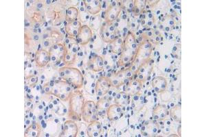 Used in DAB staining on fromalin fixed paraffin- embedded Kidney tissue