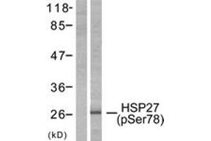Western blot analysis of extracts from HeLa cells treated with Ca2+, using HSP27 (Phospho-Ser78) Antibody. (HSP27 anticorps  (pSer78))