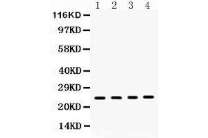 Western blot analysis of HMGB1 expression in rat brain extract ( Lane 1), mouse ovary extract ( Lane 2), 22RV1 whole cell lysates ( Lane 3) and HELA whole cell lysates ( Lane 4).