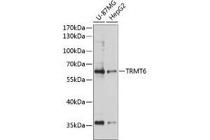 Western blot analysis of extracts of various cell lines, using TRMT6 antibody (ABIN6133079, ABIN6149556, ABIN6149557 and ABIN6224931) at 1:3000 dilution. (TRMT6 anticorps  (AA 1-200))