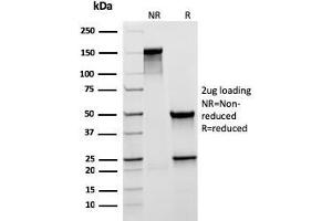 SDS-PAGE Analysis Purified MUC5AC Recombinant Mouse Monoclonal Antibody (rMUC5AC/3779).