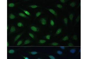 Immunofluorescence analysis of U-2 OS cells using LBR Polyclonal Antibody at dilution of 1:100 (40x lens). (Lamin B Receptor anticorps)