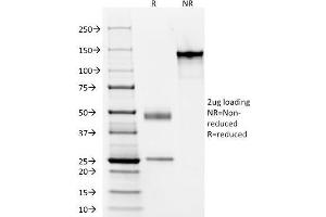 SDS-PAGE Analysis Purified Cytokeratin, LMW Monoclonal Antibody (AE-1). (Keratin 77 anticorps)