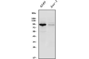 Western blot analysis of Integrin beta 5/ITGB5 using anti-Integrin beta 5/ITGB5 antibody (ABIN7601320).