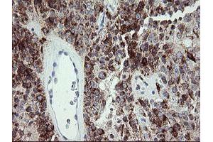 Image no. 2 for anti-Cyclin-Dependent Kinase Inhibitor 2B (p15, Inhibits CDK4) (CDKN2B) antibody (ABIN1497444)