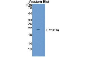 Western Blotting (WB) image for anti-Regenerating Islet-Derived 1 beta (REG1B) (AA 23-166) antibody (ABIN1870282) (REG1B anticorps  (AA 23-166))