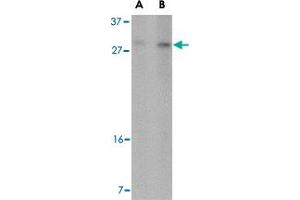 Western blot analysis of DDIT4 in 293 cell lysate with DDIT4 polyclonal antibody  at (A) 2 and (B) 4 ug/mL . (DDIT4 anticorps  (Internal Region))