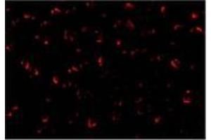Immunofluorescence of ASK1 in A431 cells with AP30085PU-N ASK1 antibody at 20 μg/ml. (ASK1 anticorps  (C-Term))