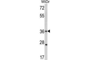 Western Blotting (WB) image for anti-Gap Junction Protein, beta 3, 31kDa (GJB3) antibody (ABIN2998428) (Connexin 31 anticorps)