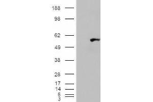 HEK293 overexpressing WIPF1 (ABIN5409971) and probed with ABIN334525 (mock transfection in first lane). (WIPF1 anticorps  (C-Term))