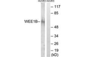 Western Blotting (WB) image for anti-WEE1 Homolog 2 (S. Pombe) (WEE2) (AA 151-200) antibody (ABIN2890693)