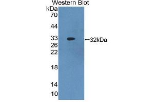Figure. (ABCB8 anticorps  (AA 472-735))