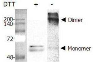 Nicotinamide phosphoribosyltransferase (NAMPT) (AA 1-491) (Active) protein (His tag)
