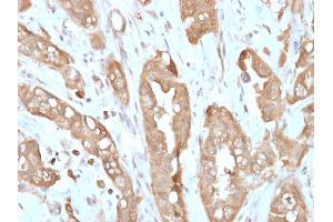 Formalin-fixed, paraffin-embedded human Small Intestine stained with Villin Rabbit Recombinant Monoclonal Antibody (VIL1/2310R). (Recombinant Villin 1 anticorps  (AA 179-311))