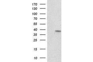 Western Blotting (WB) image for anti-Retinol Dehydrogenase 14 (All-Trans/9-Cis/11-Cis) (RDH14) antibody (ABIN1500657) (RDH14 anticorps)