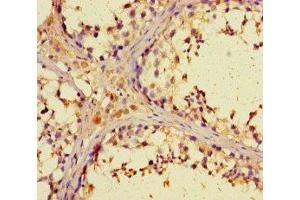 Immunohistochemistry of paraffin-embedded human testis tissue using ABIN7176469 at dilution of 1:100 (ZNF662 anticorps  (AA 182-452))