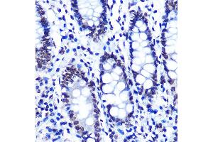 Immunohistochemistry of paraffin-embedded human colon using Phospho-SMC1-S957 Rabbit mAb (ABIN7270613) at dilution of 1:100 (40x lens). (SMC1A anticorps  (pSer957))